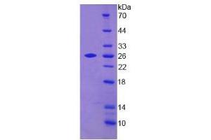 Image no. 1 for Transgelin 2 (TAGLN2) (AA 2-199) protein (His tag) (ABIN4990466) (TAGLN2 Protein (AA 2-199) (His tag))