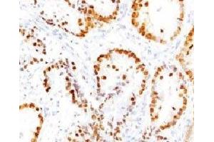 IHC testing of FFPE human lung tissue with TTF1 antibody (clone HBNK2-1) (TTF1 anticorps)