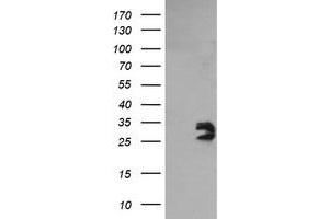 Image no. 1 for anti-Glioblastoma Amplified Sequence (GBAS) antibody (ABIN1498394) (GBAS anticorps)