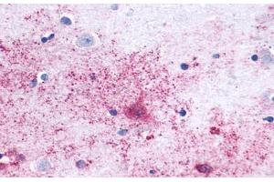 Anti-MAS1 antibody  ABIN1049039 IHC staining of human brain, neurons and glia.