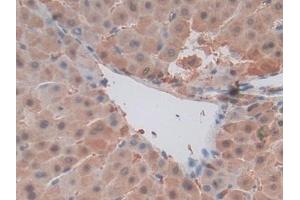 Detection of MIF in Human Liver Tissue using Polyclonal Antibody to Macrophage Migration Inhibitory Factor (MIF)