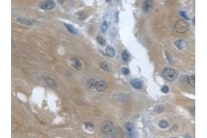 Detection of TGFa in Human Esophagus Tissue using Monoclonal Antibody to Transforming Growth Factor Alpha (TGFa)