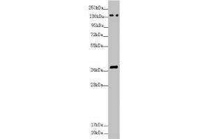 Western blot All lanes: SFI1 antibody at 4. (SFI1 anticorps  (AA 1003-1242))