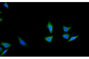Detection of CK18 in Human HepG2 cell using Monoclonal Antibody to Cytokeratin 18 (CK18)