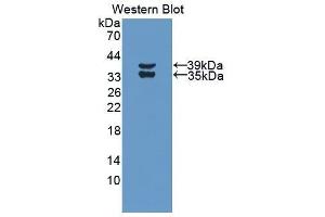Western Blotting (WB) image for anti-Complement Fragment 3a (C3a) (AA 671-748) antibody (ABIN1858189)