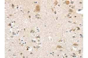 The image on the left is immunohistochemistry of paraffin-embedded Human brain tissue using ABIN7193032(VSIG10 Antibody) at dilution 1/45, on the right is treated with synthetic peptide. (VSIG1 anticorps)