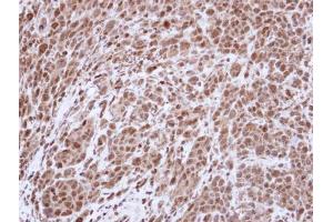 IHC-P Image Immunohistochemical analysis of paraffin-embedded SAS Xenograft , using Topoisomerase II alpha , antibody at 1:500 dilution.
