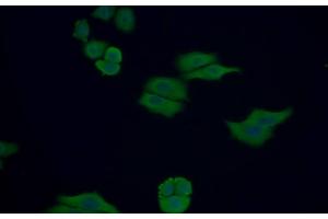 Detection of Trx in Human MCF7 cell using Polyclonal Antibody to Thioredoxin (Trx) (TXN anticorps  (AA 1-105))