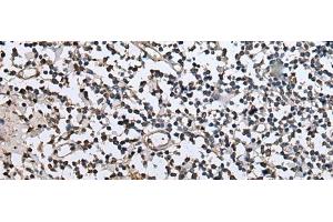 Immunohistochemistry of paraffin-embedded Human tonsil tissue using ZFP36 Polyclonal Antibody at dilution of 1:40(x200)