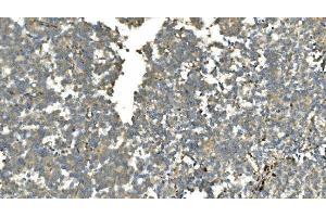 IHC analysis of Carbonic Anhydrase 13/CA13 using anti-Carbonic Anhydrase 13/CA13 antibody (ABIN7603164). (CA13 anticorps  (N-Term))