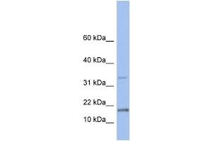 WB Suggested Anti-TCL1A Antibody Titration: 0. (TCL1A anticorps  (N-Term))