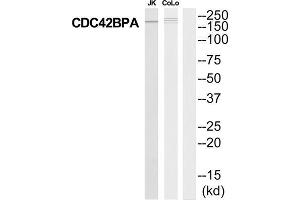 Western Blotting (WB) image for anti-CDC42 Binding Protein Kinase alpha (DMPK-Like) (CDC42BPA) (Internal Region) antibody (ABIN1852716) (CDC42BPA anticorps  (Internal Region))