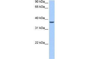 WB Suggested Anti-ALKBH8 Antibody Titration:  0. (ALKBH8 anticorps  (N-Term))