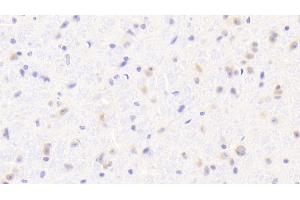 Detection of IBA1 in Mouse Cerebrum Tissue using Polyclonal Antibody to Ionized Calcium-binding Adapter Molecule 1 (IBA1)