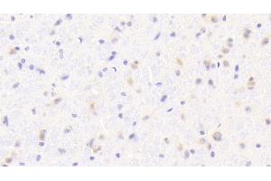 Detection of IBA1 in Mouse Cerebrum Tissue using Polyclonal Antibody to Ionized Calcium-binding Adapter Molecule 1 (IBA1) (Iba1 anticorps  (AA 35-102))