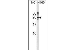 RAT Ppp1r2 Antibody (Center) (ABIN1881680 and ABIN2839055) western blot analysis in NCI- cell line lysates (35 μg/lane). (PPP1R2 anticorps  (AA 49-77))