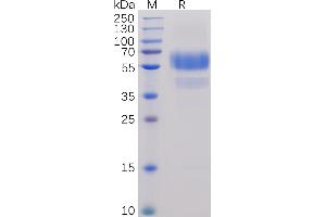Human CD70 Protein, hFc-His Tag on SDS-PAGE under reducing condition.