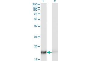 Western Blot analysis of TSC22D1 expression in transfected 293T cell line by TSC22D1 monoclonal antibody (M06), clone 2E2. (TSC22D1 anticorps  (AA 1-144))
