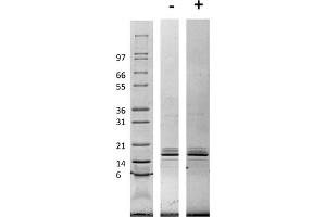 SDS-PAGE of Rat Monocyte Chemotactic Protein-1 (CCL2) Recombinant Protein SDS-PAGE of Rat Monocyte Chemotactic Protein-1 (CCL2) Recombinant Protein. (CCL2 Protéine)
