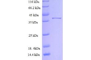 SDS-PAGE (SDS) image for Solute Carrier Family 39 (Zinc Transporter), Member 13 (SLC39A13) (AA 130-233) protein (His-GST) (ABIN5711359) (SLC39A13 Protein (AA 130-233) (His-GST))