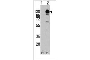 Image no. 1 for anti-Platelet Derived Growth Factor Receptor alpha (PDGFRA) (Tyr762) antibody (ABIN359910) (PDGFRA anticorps  (Tyr762))