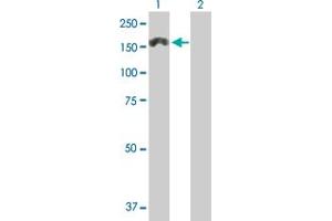 Western Blot analysis of MTMR3 expression in transfected 293T cell line by MTMR3 MaxPab polyclonal antibody. (MTMR3 anticorps  (AA 1-1198))