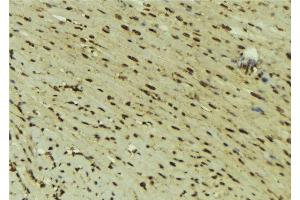 ABIN6277618 at 1/100 staining Mouse muscle tissue by IHC-P. (DNMT1 anticorps  (Internal Region))