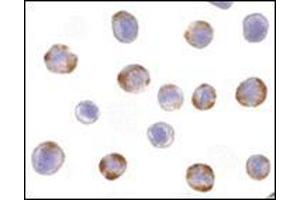 Immunocytochemistry of NOD2 in HeLa cells with this product at 10 μg/ml.