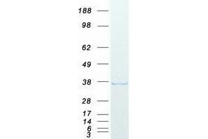 Validation with Western Blot