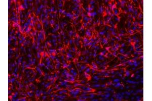 Immunofluorescence staining of paraffin-embedded Glioma cells of Spinal Cord using MAP2 Antibody. (MAP2 anticorps)