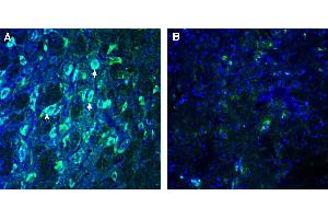 Expression of GPR108 in mouse red nucleus. (GPR108 anticorps  (Extracellular))