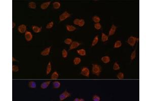Immunofluorescence analysis of L929 cells using ACSS1 Polyclonal Antibody at dilution of 1:100. (ACSS1 anticorps)
