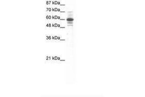 Image no. 1 for anti-Zinc Finger Protein 276 (ZNF276) (AA 284-333) antibody (ABIN6736062) (ZNF276 anticorps  (AA 284-333))