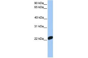 Factor X antibody used at 1 ug/ml to detect target protein. (Coagulation Factor X anticorps  (C-Term))