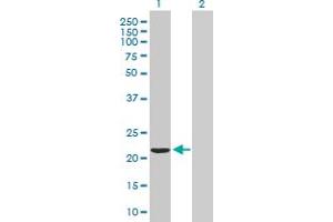 Western Blot analysis of VBP1 expression in transfected 293T cell line by VBP1 MaxPab polyclonal antibody. (VBP1 anticorps  (AA 1-197))