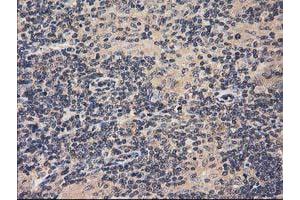 Image no. 6 for anti-Acyl-CoA Thioesterase 12 (ACOT12) antibody (ABIN1496415)