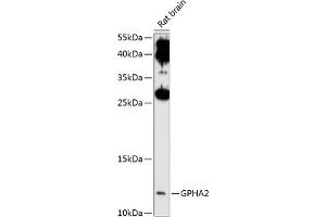 Western blot analysis of extracts of rat brain, using GPH antibody (ABIN6132023, ABIN6141322, ABIN6141323 and ABIN6214909) at 1:1000 dilution.