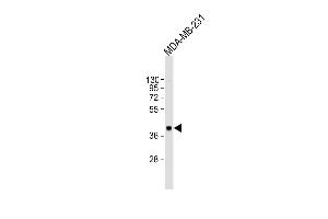 Anti-CYR61 Antibody (Center) at 1:2000 dilution + MDA-MB-231 whole cell lysate Lysates/proteins at 20 μg per lane. (CYR61 anticorps  (AA 143-174))