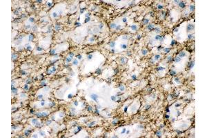 Anti- Munc18-1 Picoband antibody, IHC(P) IHC(P): Human Glioma Tissue (STXBP1 anticorps  (N-Term))