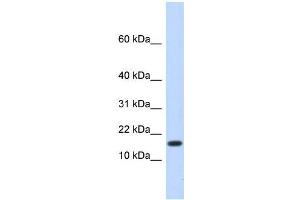 Human Liver; WB Suggested Anti-HERC4 Antibody Titration: 0.