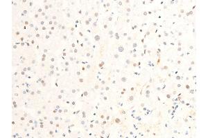 ABIN6267271 at 1/100 staining human liver tissue sections by IHC-P.