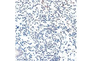 Immunohistochemistry of paraffin-embedded human appendix using P Rabbit mAb (ABIN7269152) at dilution of 1:100 (40x lens).
