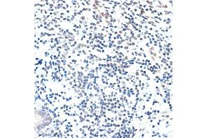 Immunohistochemistry of paraffin-embedded human appendix using P Rabbit mAb (ABIN7269152) at dilution of 1:100 (40x lens). (PAF1/PD2 anticorps)