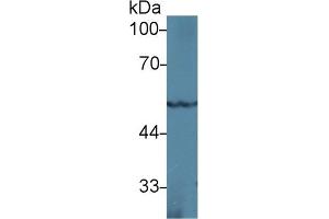 Western blot analysis of Rat Heart lysate, using Mouse PPARg Antibody (1 µg/ml) and HRP-conjugated Goat Anti-Rabbit antibody ( (PPARG anticorps  (AA 149-273))