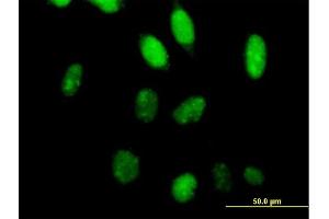 Immunofluorescence of purified MaxPab antibody to TCEA2 on HeLa cell. (TCEA2 anticorps  (AA 1-299))