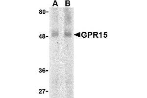 Western Blotting (WB) image for anti-G Protein-Coupled Receptor 15 (GPR15) (N-Term) antibody (ABIN1031395) (GPR15 anticorps  (N-Term))