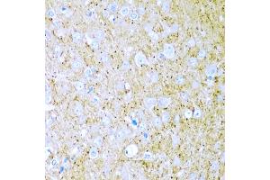 Immunohistochemistry of paraffin-embedded rat brain using WNT2 antibody (ABIN5973475) at dilution of 1/200 (40x lens). (WNT2 anticorps)