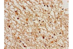 Immunohistochemistry of paraffin-embedded human brain tissue using ABIN7148834 at dilution of 1:100 (Cyclin A1 anticorps  (AA 1-152))