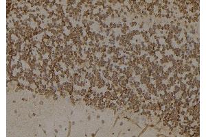 ABIN6276817 at 1/100 staining Mouse brain tissue by IHC-P. (AKR1B1 anticorps  (C-Term))