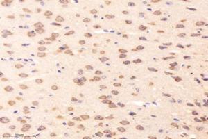 Immunohistochemistry analysis of paraffin-embedded mouse striatum using,RRAGB (ABIN7075379) at dilution of 1: 4000 (RRAGB anticorps)